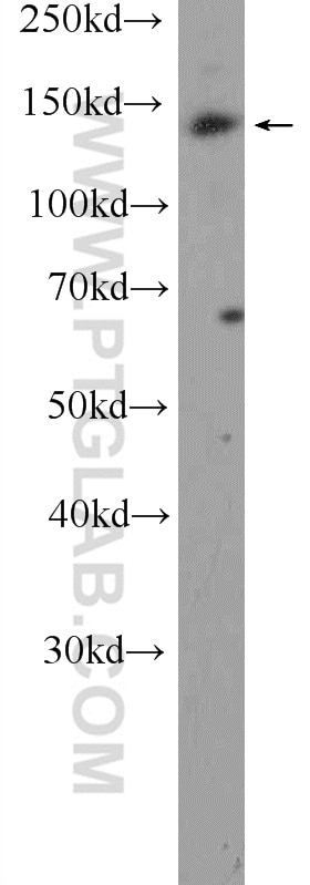 Western Blot (WB) analysis of K-562 cells using BCR Polyclonal antibody (22585-1-AP)
