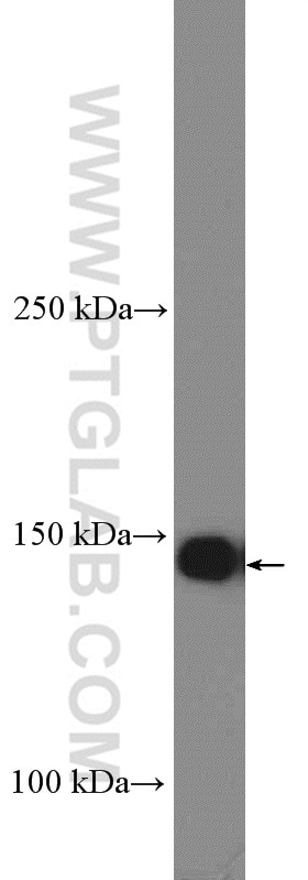 Western Blot (WB) analysis of HEK-293 cells using BCR Polyclonal antibody (22585-1-AP)