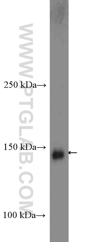 Western Blot (WB) analysis of MCF-7 cells using BCR Polyclonal antibody (22585-1-AP)