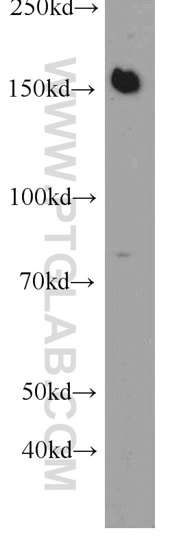 Western Blot (WB) analysis of COS-7 cells using BCR Polyclonal antibody (22585-1-AP)