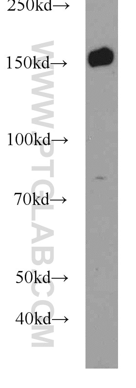 Western Blot (WB) analysis of Y79 cells using BCR Polyclonal antibody (22585-1-AP)