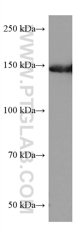 Western Blot (WB) analysis of HeLa cells using BCR Monoclonal antibody (67260-1-Ig)
