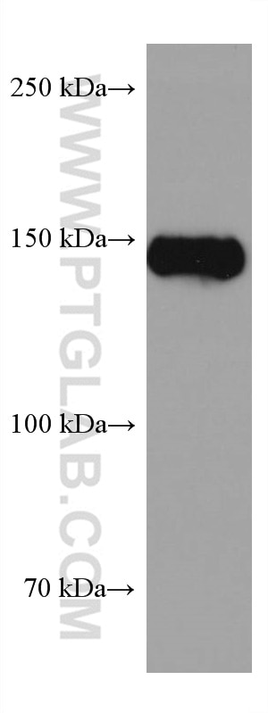 Western Blot (WB) analysis of Jurkat cells using BCR Monoclonal antibody (67260-1-Ig)