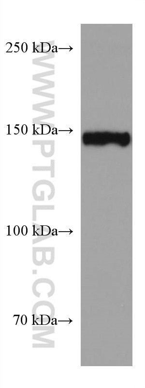 Western Blot (WB) analysis of HEK-293 cells using BCR Monoclonal antibody (67260-1-Ig)