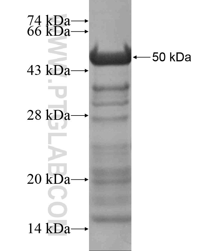 BCR fusion protein Ag18281 SDS-PAGE
