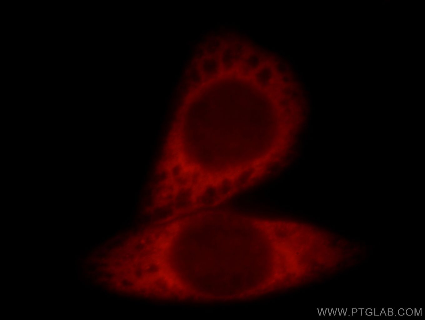 Immunofluorescence (IF) / fluorescent staining of HeLa cells using BCR-Specific Polyclonal antibody (19790-1-AP)