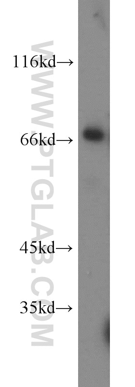 BCRP/ABCG2 Polyclonal antibody