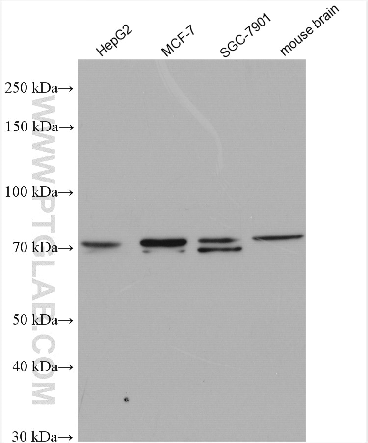 Western Blot (WB) analysis of various lysates using BCRP,ABCG2 Polyclonal antibody (27286-1-AP)