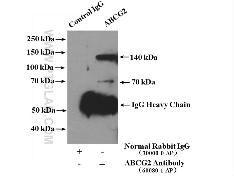 Immunoprecipitation (IP) experiment of NCCIT cells using BCRP/ABCG2 Monoclonal antibody (60080-1-Ig)