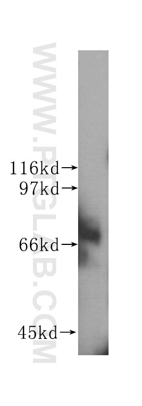 Western Blot (WB) analysis of Jurkat cells using BCRP/ABCG2 Monoclonal antibody (60080-1-Ig)