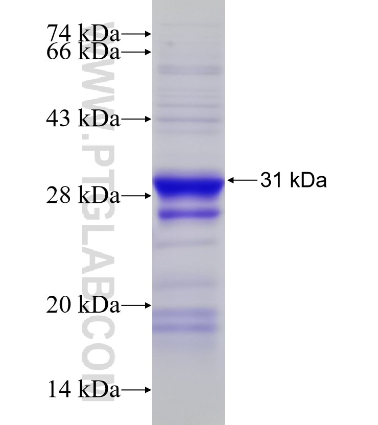 BCRP,ABCG2 fusion protein Ag0005 SDS-PAGE