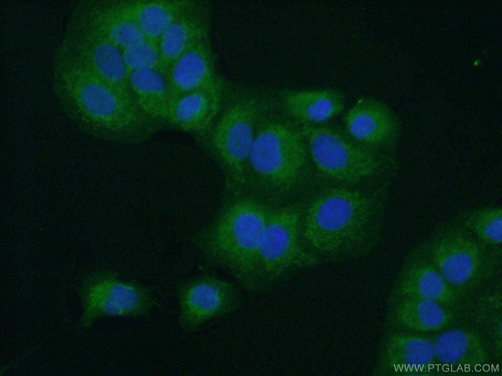 Immunofluorescence (IF) / fluorescent staining of A549 cells using BCS1L Polyclonal antibody (10175-2-AP)