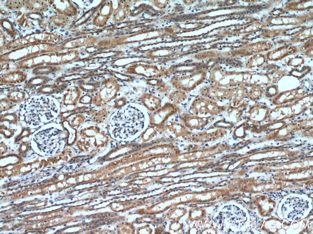 Immunohistochemistry (IHC) staining of human kidney tissue using BCS1L Polyclonal antibody (10175-2-AP)
