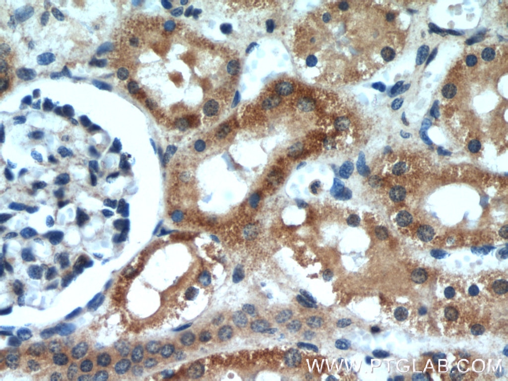 Immunohistochemistry (IHC) staining of human kidney tissue using BCS1L Polyclonal antibody (10175-2-AP)
