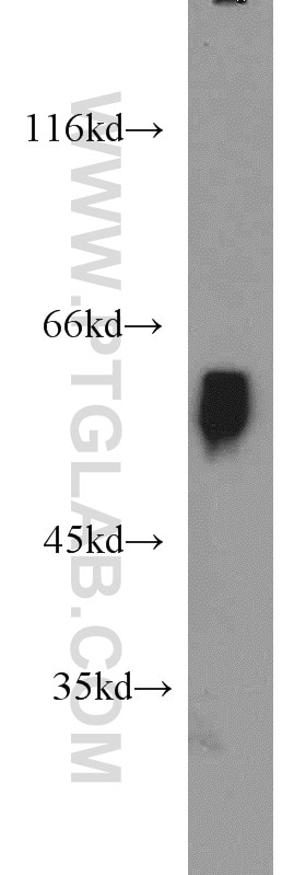 Western Blot (WB) analysis of human brain tissue using BCS1L Polyclonal antibody (10175-2-AP)