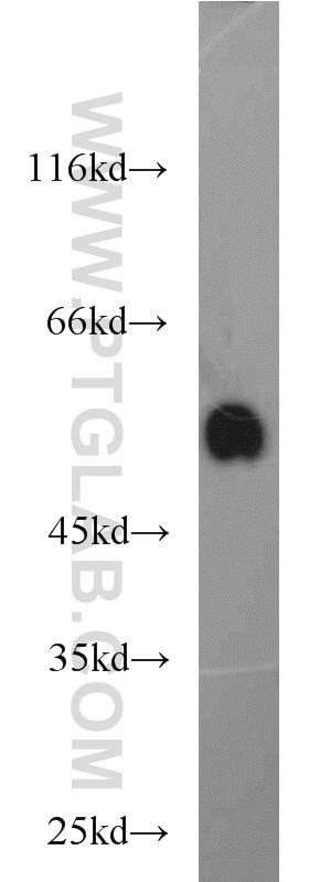 Western Blot (WB) analysis of HeLa cells using BCS1L Polyclonal antibody (10175-2-AP)