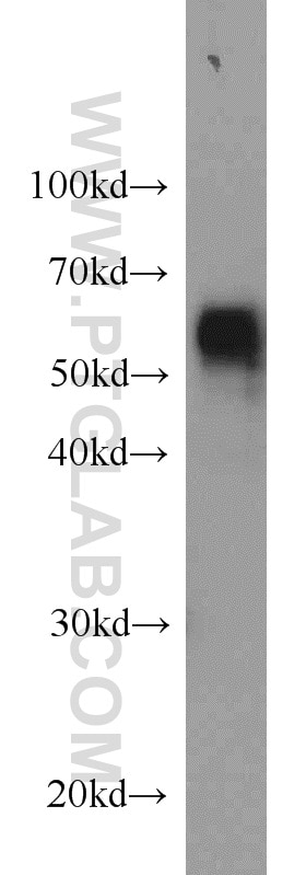 Western Blot (WB) analysis of mouse colon tissue using BCS1L Polyclonal antibody (10175-2-AP)