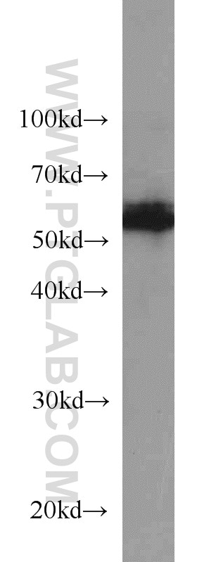 WB analysis of mouse skeletal muscle using 10175-2-AP