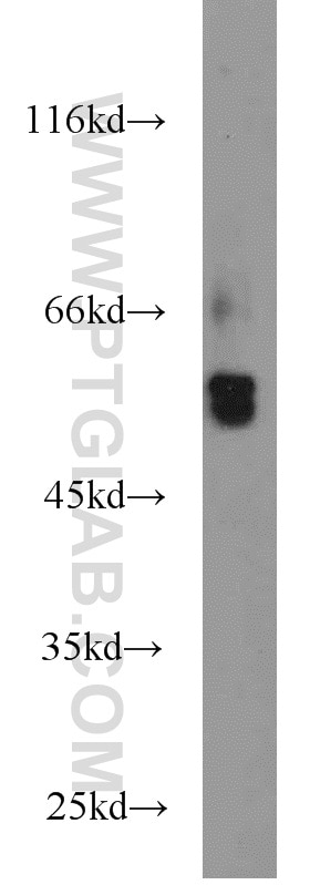 Western Blot (WB) analysis of HEK-293 cells using BCS1L Polyclonal antibody (10175-2-AP)