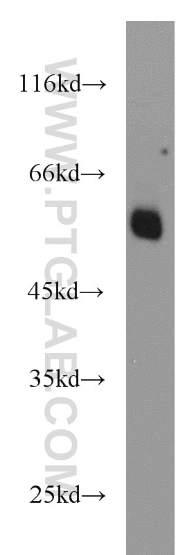 Western Blot (WB) analysis of A549 cells using BCS1L Polyclonal antibody (10175-2-AP)