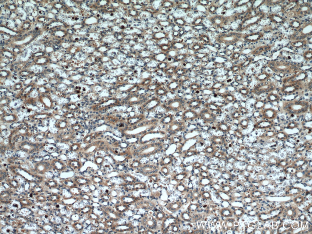 Immunohistochemistry (IHC) staining of human kidney tissue using BCS1L Monoclonal antibody (60212-1-Ig)