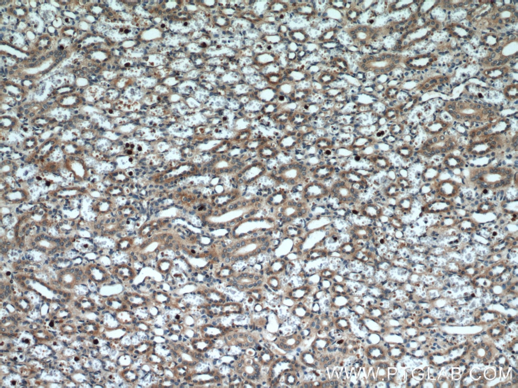 IHC staining of human kidney using 60212-1-Ig