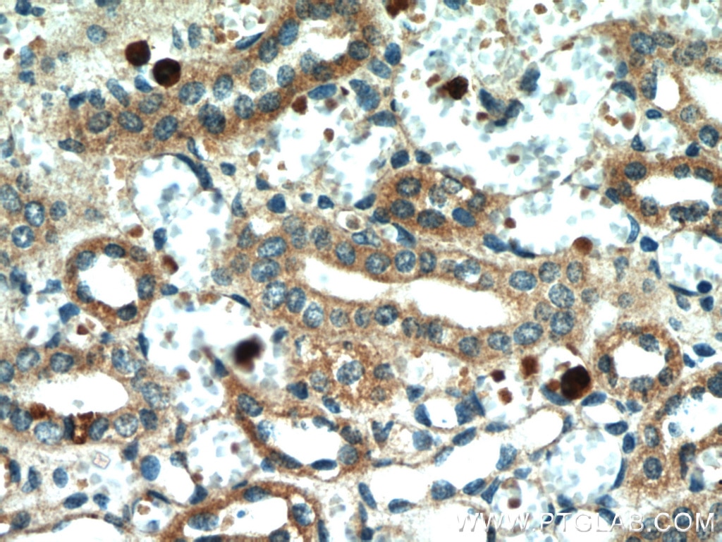 IHC staining of human kidney using 60212-1-Ig