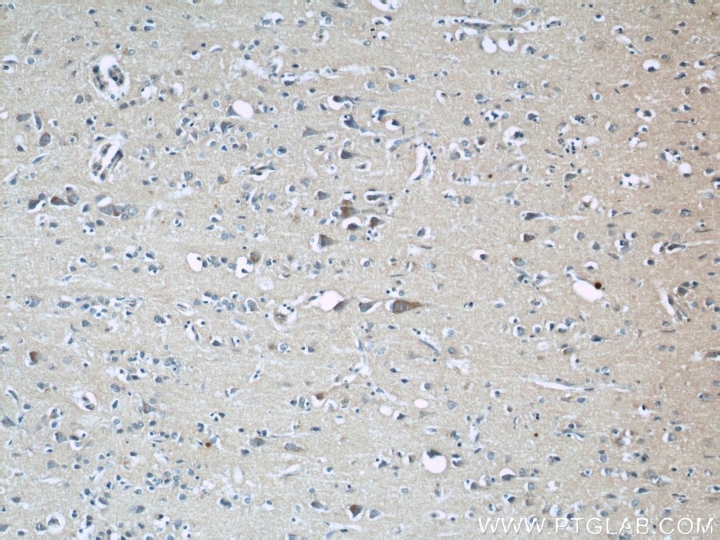 Immunohistochemistry (IHC) staining of human brain tissue using BCS1L Monoclonal antibody (60212-1-Ig)