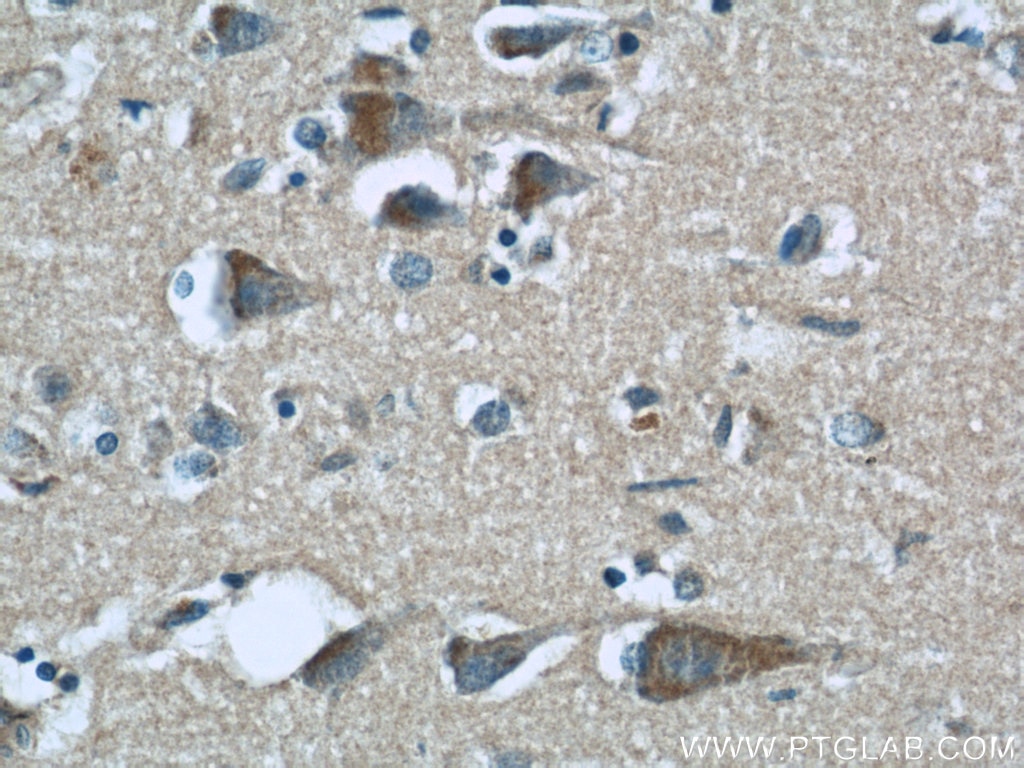 Immunohistochemistry (IHC) staining of human brain tissue using BCS1L Monoclonal antibody (60212-1-Ig)