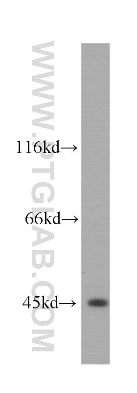 Western Blot (WB) analysis of COLO 320 cells using BCS1L Monoclonal antibody (60212-1-Ig)