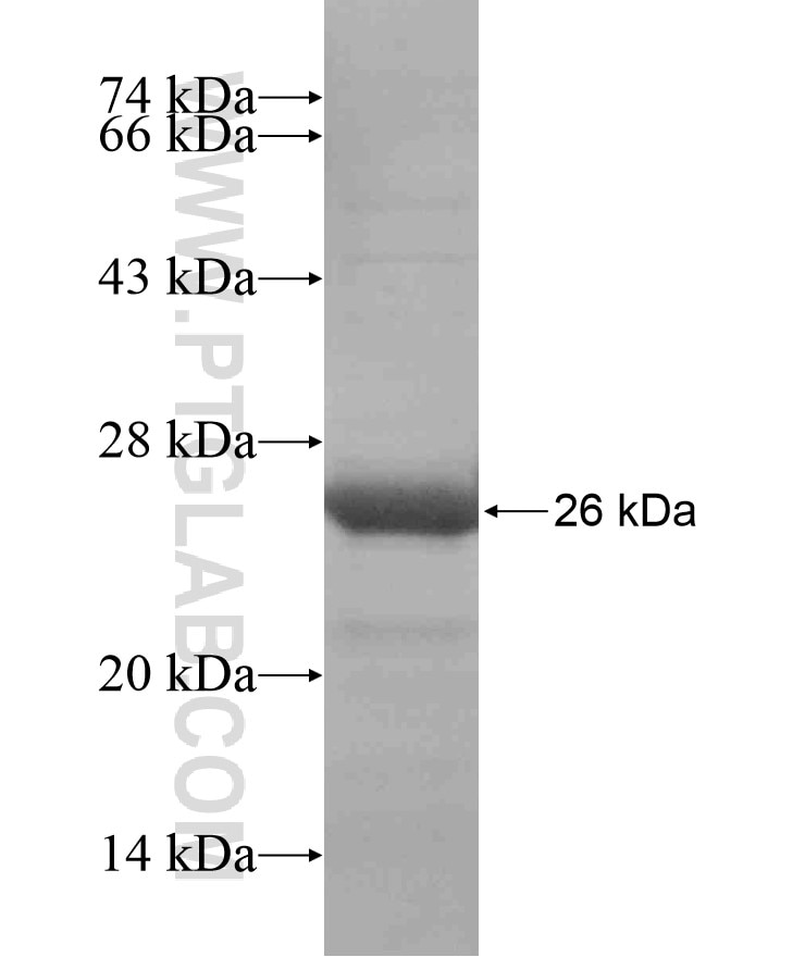 BCS1L fusion protein Ag18280 SDS-PAGE