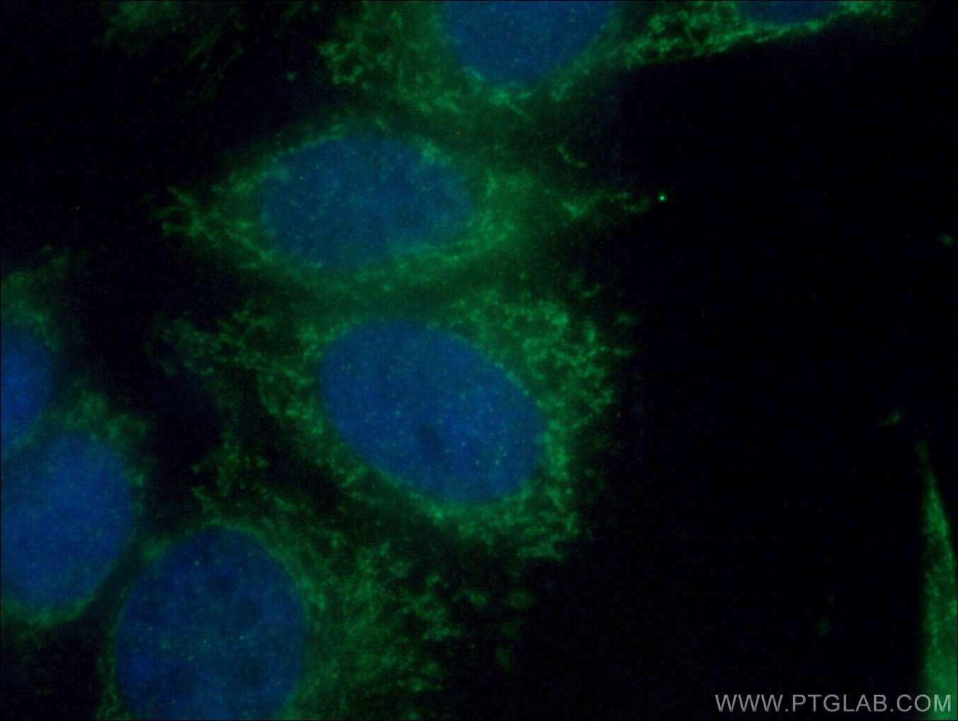 Immunofluorescence (IF) / fluorescent staining of HepG2 cells using BDH1 Polyclonal antibody (15417-1-AP)