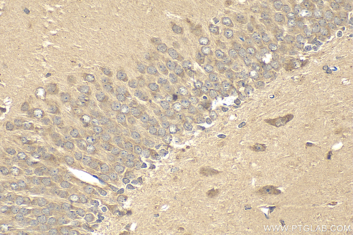 Immunohistochemistry (IHC) staining of rat brain tissue using BDH1 Polyclonal antibody (15417-1-AP)