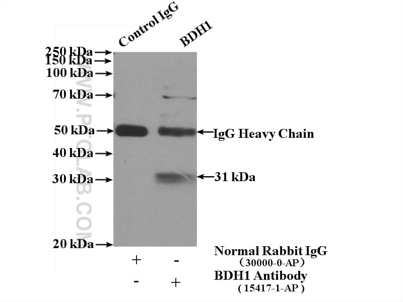 Immunoprecipitation (IP) experiment of mouse liver tissue using BDH1 Polyclonal antibody (15417-1-AP)