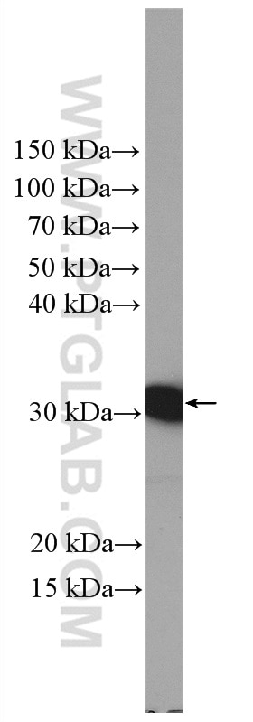 WB analysis of COLO 320 using 15417-1-AP