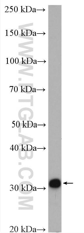 Western Blot (WB) analysis of rat liver tissue using BDH1 Polyclonal antibody (15417-1-AP)