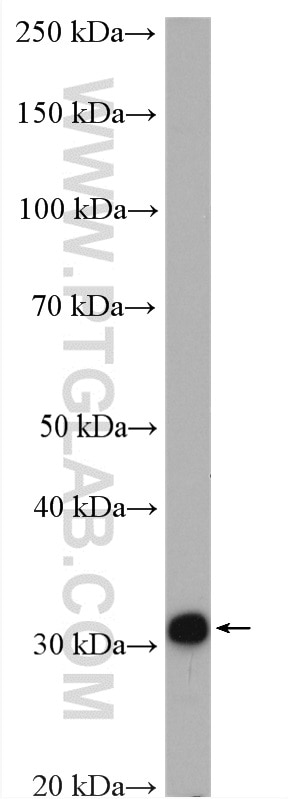 WB analysis of rat liver using 15417-1-AP