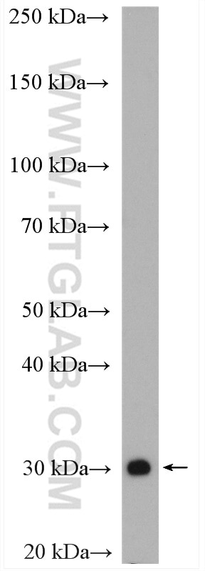 Western Blot (WB) analysis of mouse liver tissue using BDH1 Polyclonal antibody (15417-1-AP)