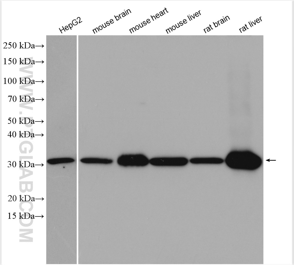 Western Blot (WB) analysis of various lysates using BDH1 Polyclonal antibody (15417-1-AP)