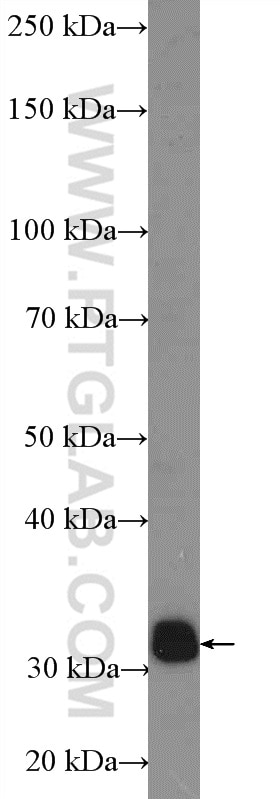 WB analysis of rat brain using 15417-1-AP