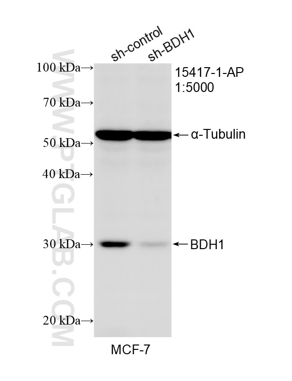 WB result of BDH1 antibody (15417-1-AP; 1:5000; incubated at room temperature for 1.5 hours) with sh-Control and sh-BDH1 transfected MCF-7 cells. Western Blot (WB) analysis of MCF-7 cells using BDH1 Polyclonal antibody (15417-1-AP)