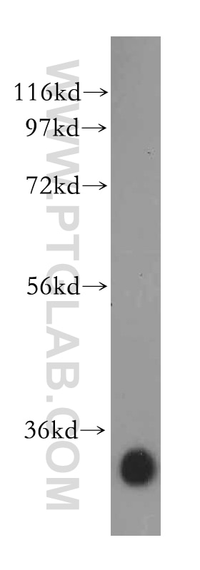 WB analysis of human liver using 15417-1-AP