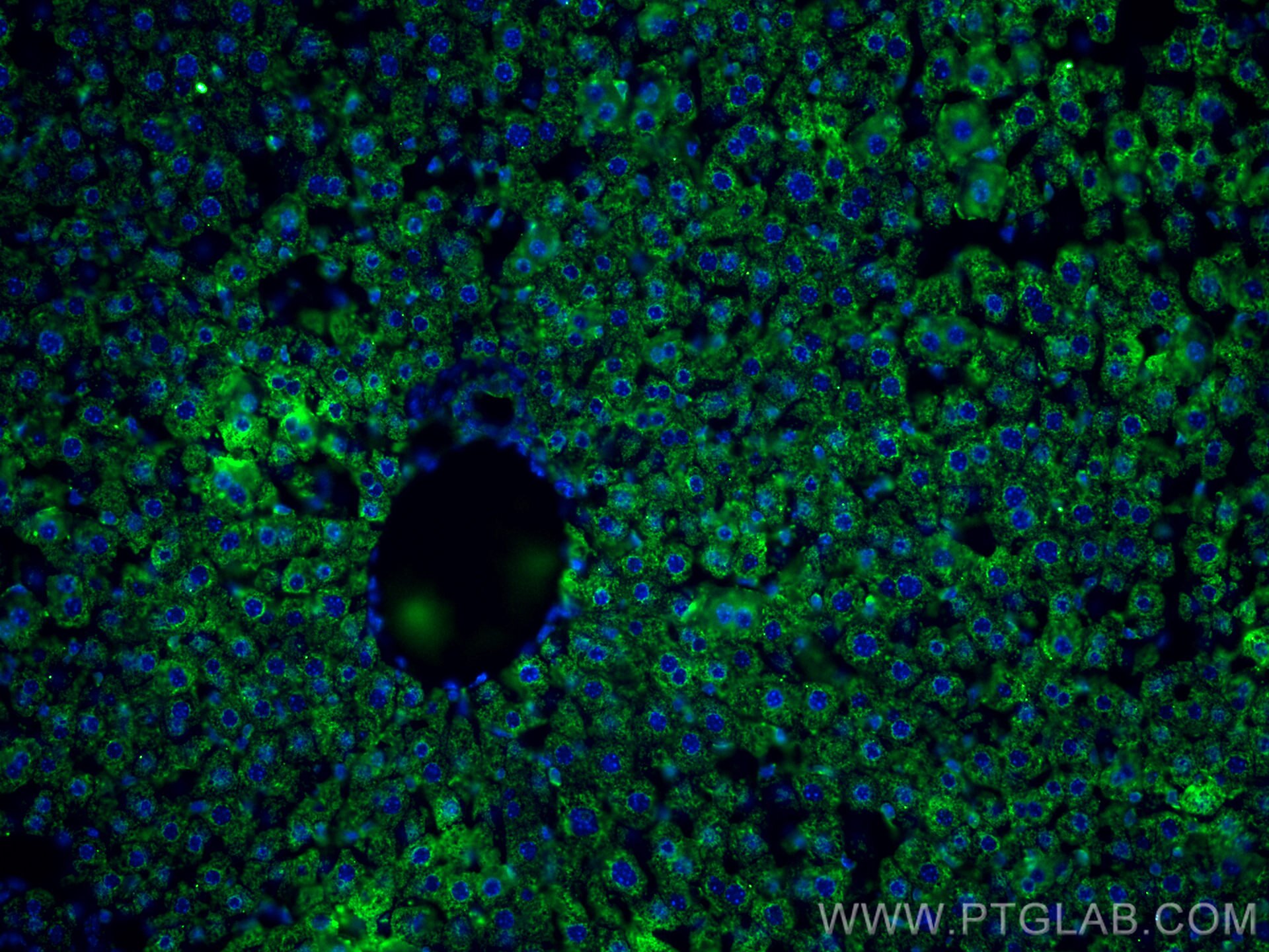 Immunofluorescence (IF) / fluorescent staining of mouse liver tissue using BDH1 Monoclonal antibody (67448-1-Ig)