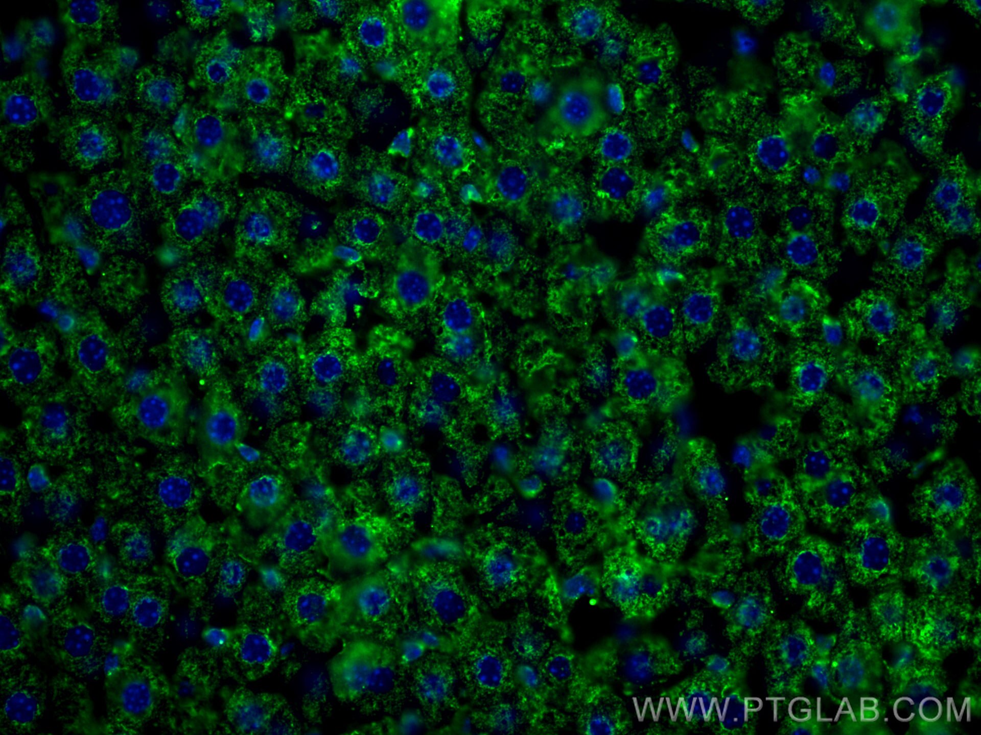 Immunofluorescence (IF) / fluorescent staining of mouse liver tissue using BDH1 Monoclonal antibody (67448-1-Ig)