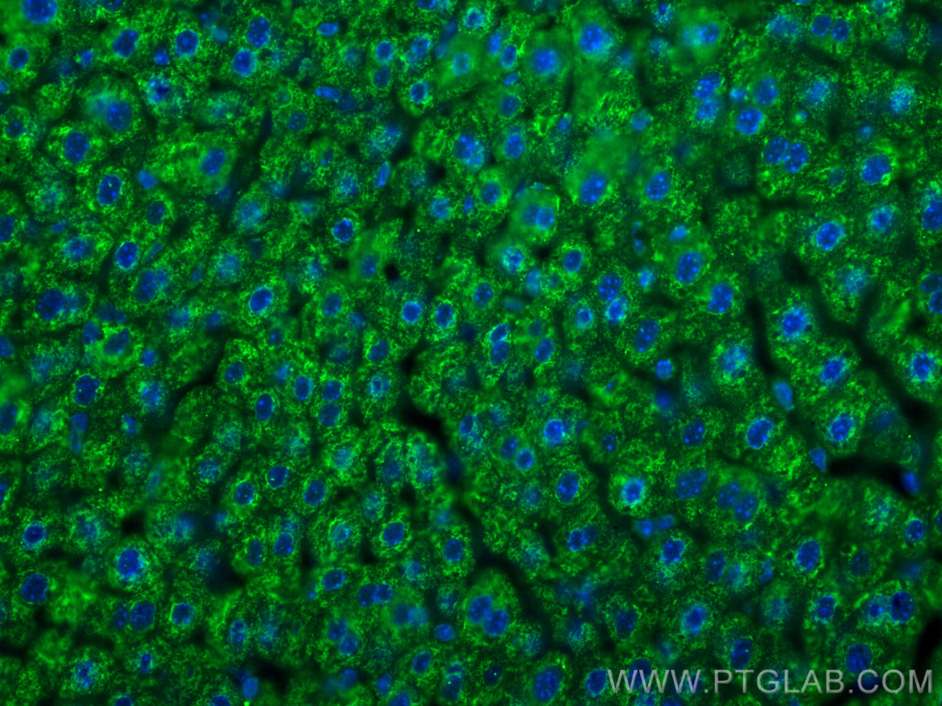 Immunofluorescence (IF) / fluorescent staining of mouse liver tissue using CoraLite® Plus 488-conjugated BDH1 Monoclonal anti (CL488-67448)