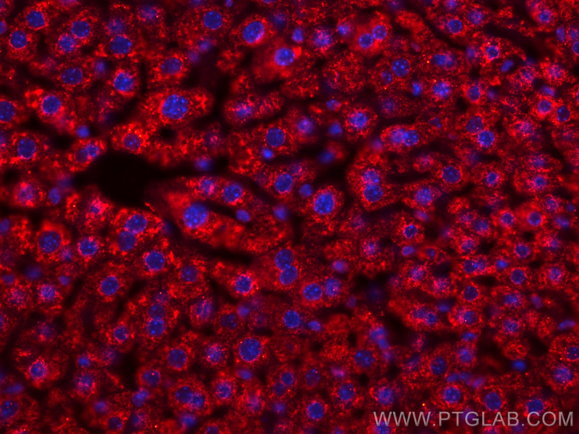 Immunofluorescence (IF) / fluorescent staining of mouse liver tissue using CoraLite®594-conjugated BDH1 Monoclonal antibody (CL594-67448)