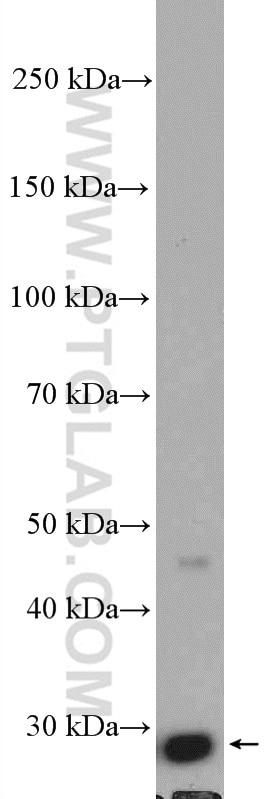 WB analysis of HeLa using 27207-1-AP