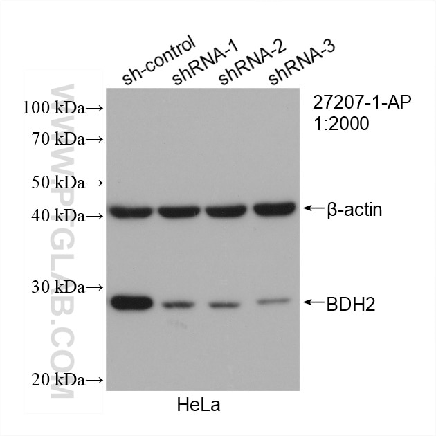 Western Blot (WB) analysis of HeLa cells using BDH2 Polyclonal antibody (27207-1-AP)