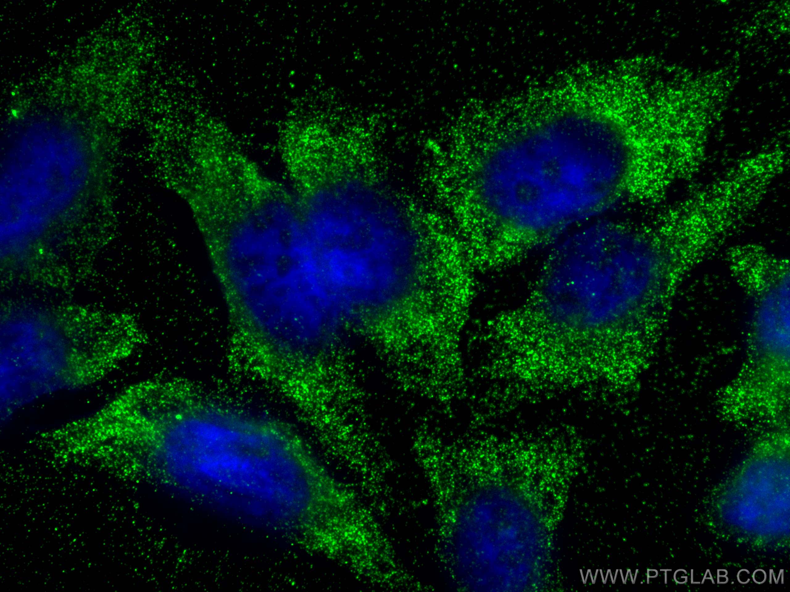 Immunofluorescence (IF) / fluorescent staining of HepG2 cells using BDH2 Monoclonal antibody (68279-1-Ig)