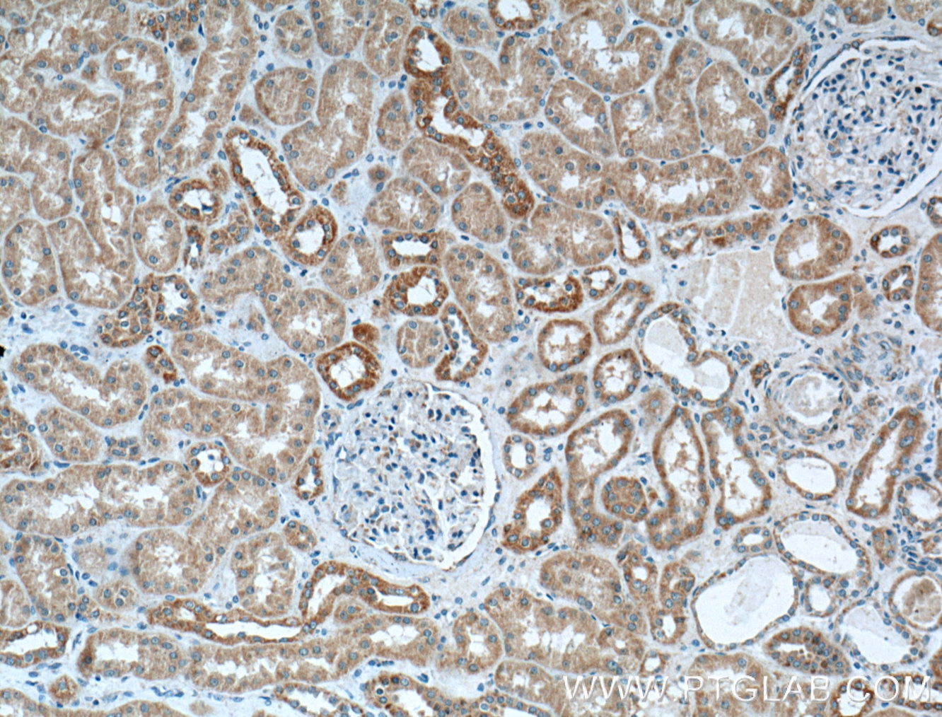 Immunohistochemistry (IHC) staining of human kidney tissue using BDKRB1 Polyclonal antibody (26672-1-AP)